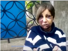 Херсонская жуть: грабители жестоко избили женщину за горстку серебра