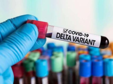 НАН пугает ростом заболеваемости COVID-19 на Украине, пока доля «Дельта»-штамма не дойдёт до 90%